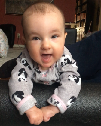 warburg micro syndrome